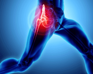 Hip joint