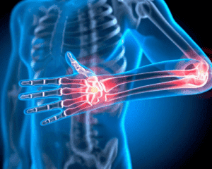 Elbow joint